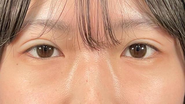 Postoperative Condition Part 1