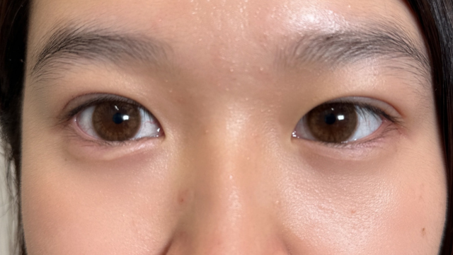 Postoperative Condition Part 1