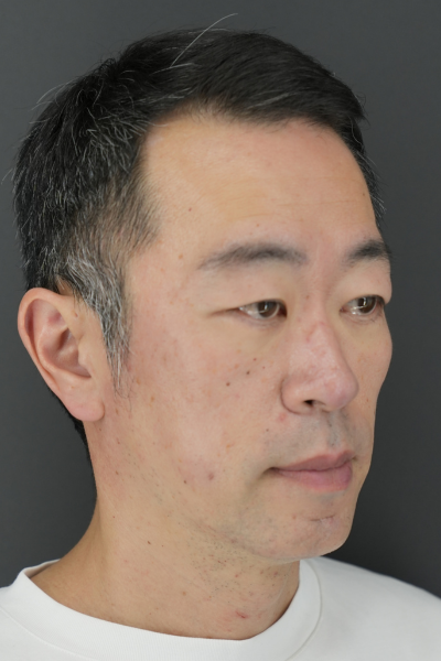 Postoperative Condition Part 1