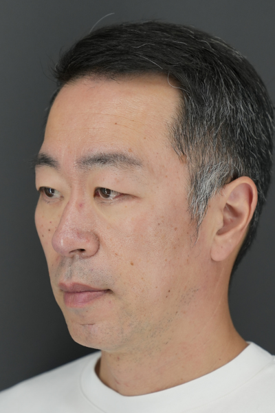 Postoperative Condition Part 1