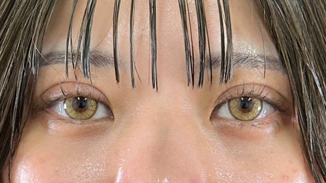 Postoperative Condition Part 1