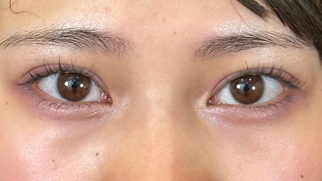 Postoperative Condition Part 1