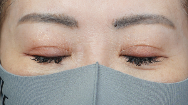 Postoperative Condition Part 1