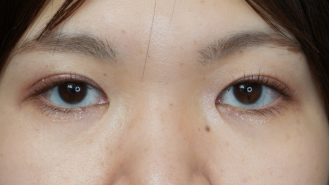 Postoperative Condition Part 1