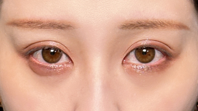 Postoperative Condition Part 1