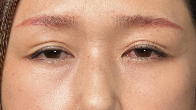 Postoperative Condition Part 1