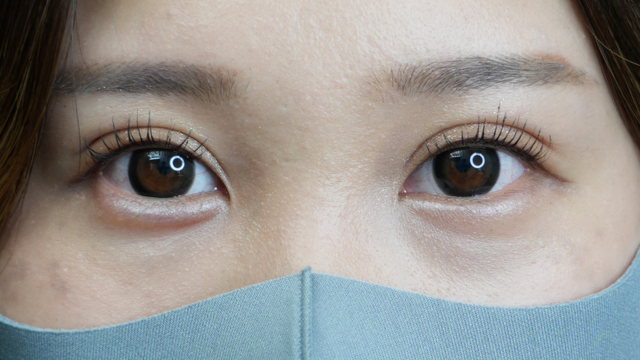 Postoperative Condition Part 1