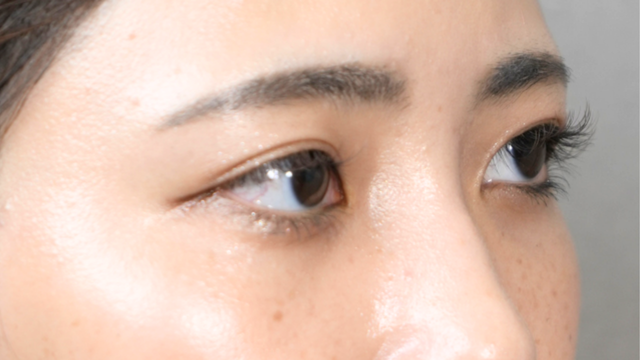 Postoperative Condition Part 1