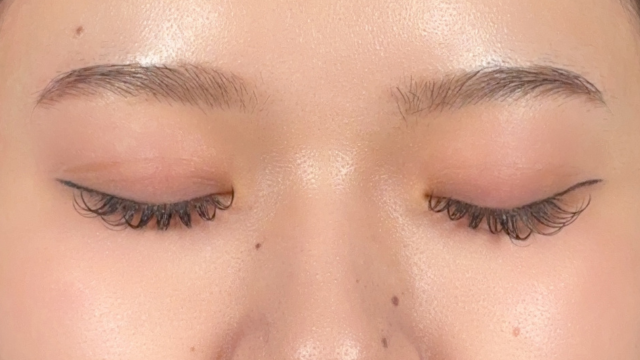 Postoperative Condition Part 1