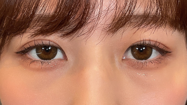 Postoperative Condition Part 1