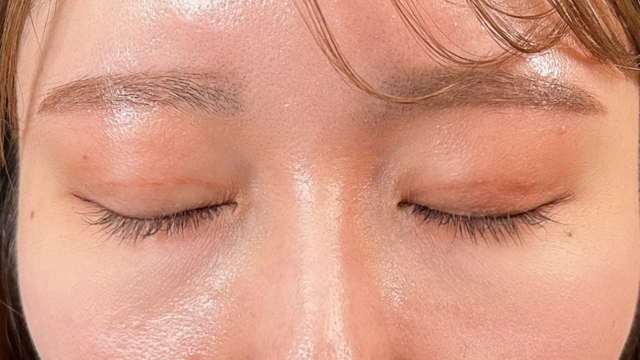 Postoperative Condition Part 1