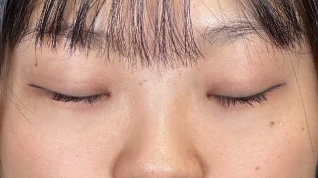 Postoperative Condition Part 1