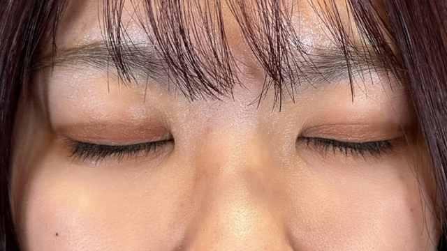 Postoperative Condition Part 1