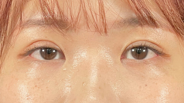 Postoperative Condition Part 1