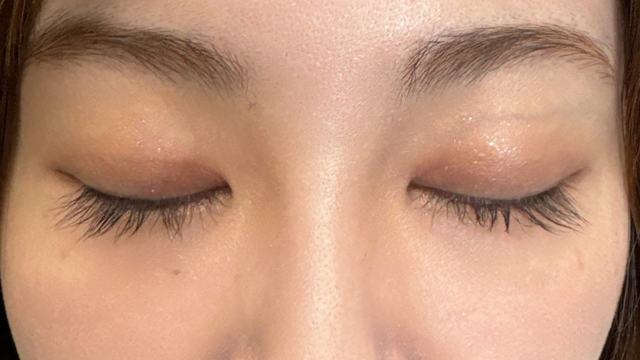 Postoperative Condition Part 1