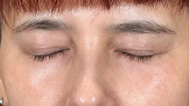 Postoperative Condition Part 1