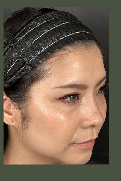 手術前の状態 その1