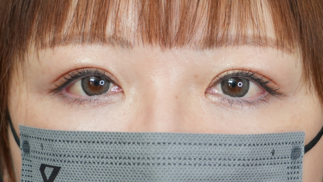 Postoperative Condition Part 1