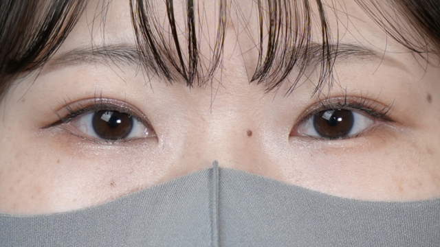 Postoperative Condition Part 1