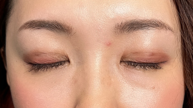 Postoperative Condition Part 1