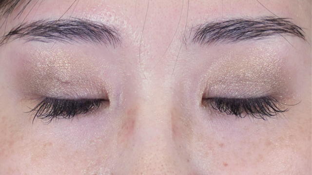 Postoperative Condition Part 1