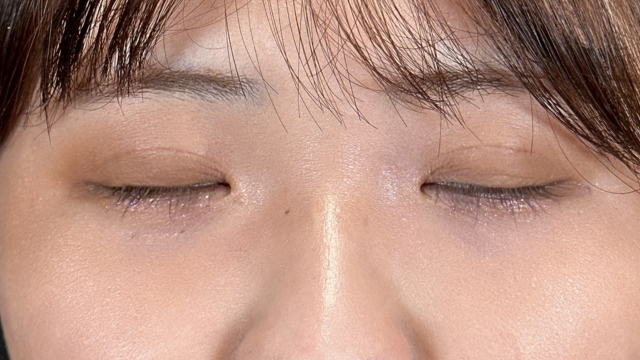 Postoperative Condition Part 1