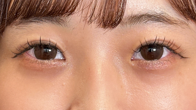 Postoperative Condition Part 1