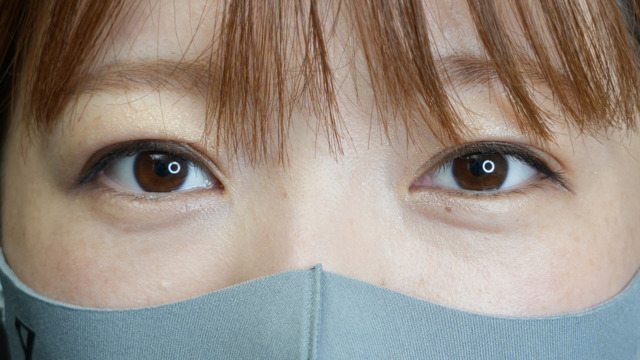 Postoperative Condition Part 1