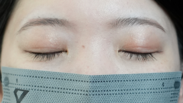 Postoperative Condition Part 1