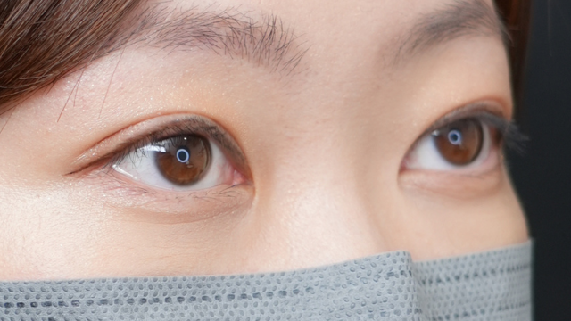 Postoperative Condition Part 1