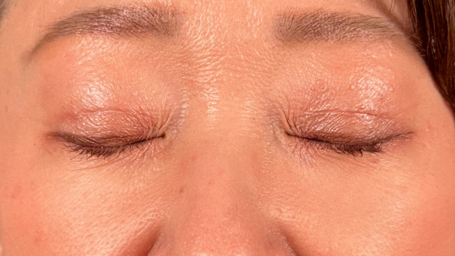 Postoperative Condition Part 1