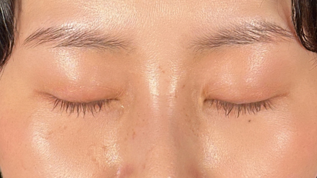 Postoperative Condition Part 1