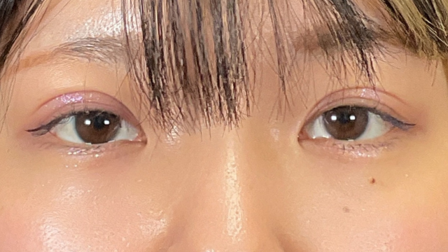 Postoperative Condition Part 1