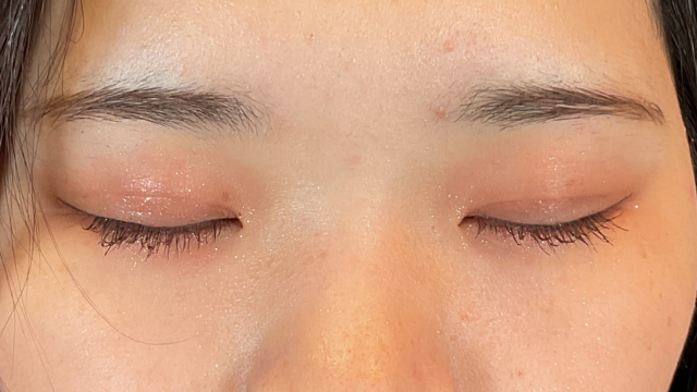 Postoperative Condition Part 1