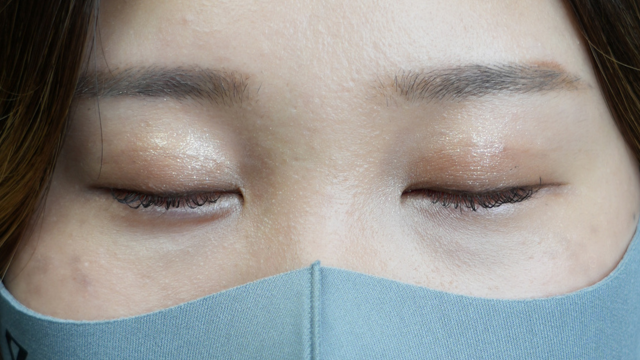 Postoperative Condition Part 1