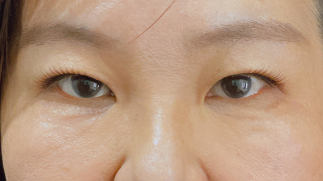 Postoperative Condition Part 1