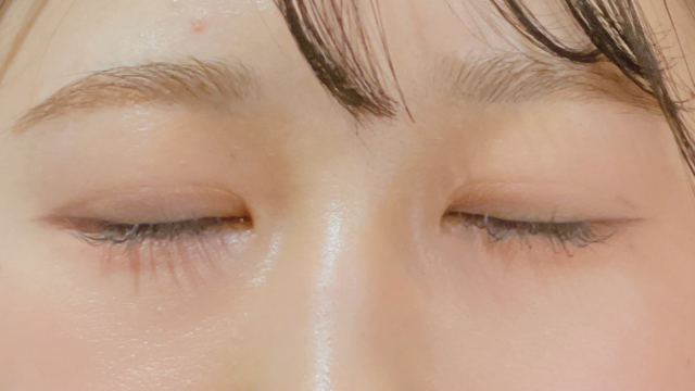 Postoperative Condition Part 1