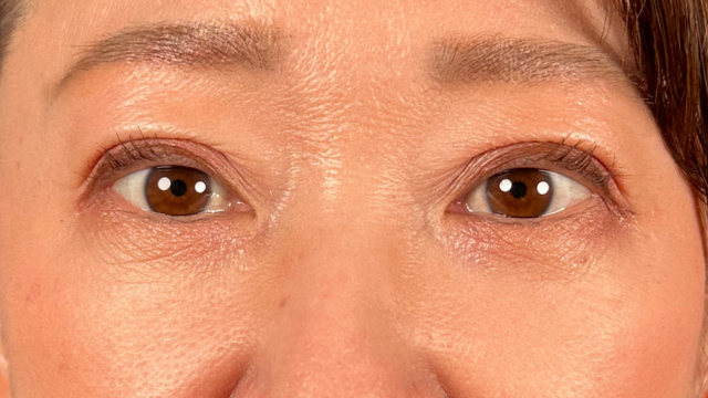 Postoperative Condition Part 1