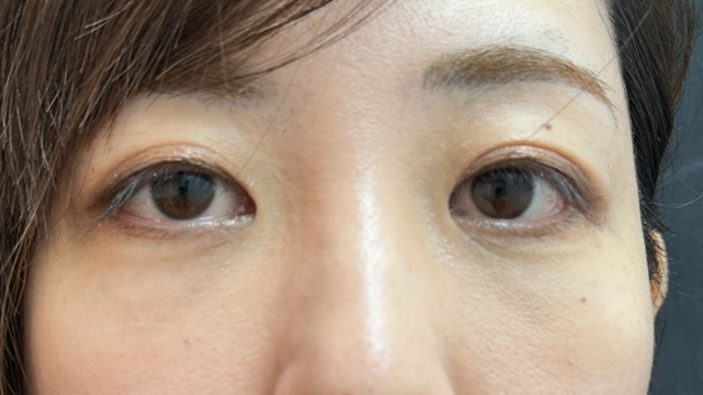 Postoperative Condition Part 1