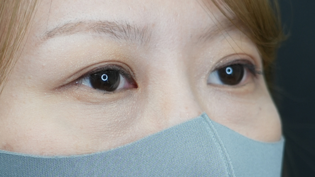 Postoperative Condition Part 1