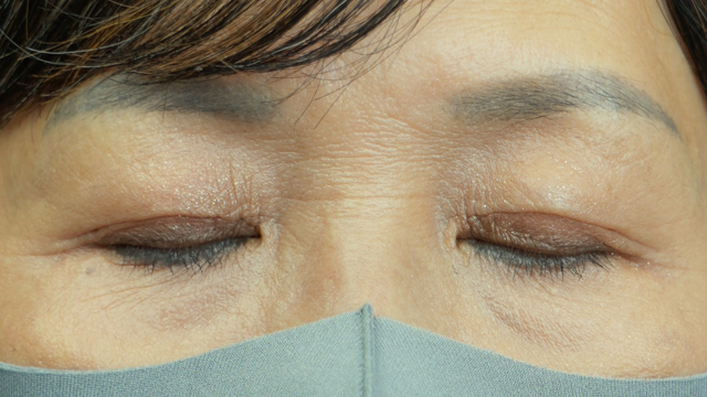 Postoperative Condition Part 1