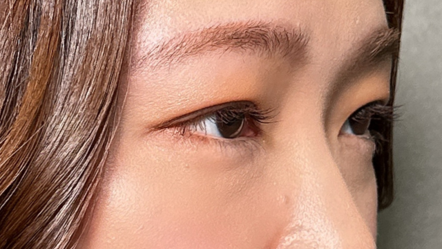 Postoperative Condition Part 1