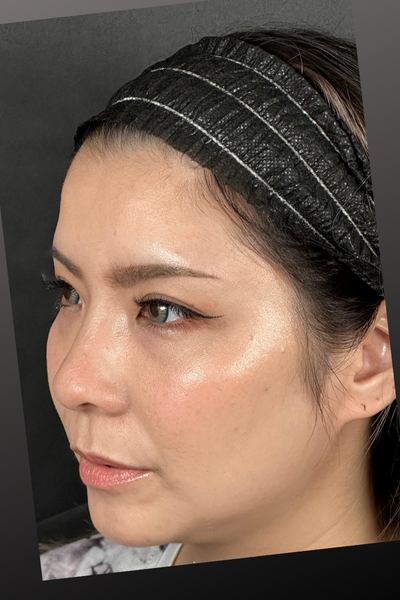 手術前の状態 その1