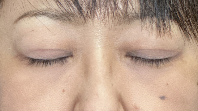 Postoperative Condition Part 1