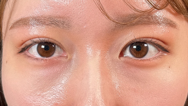 Postoperative Condition Part 1