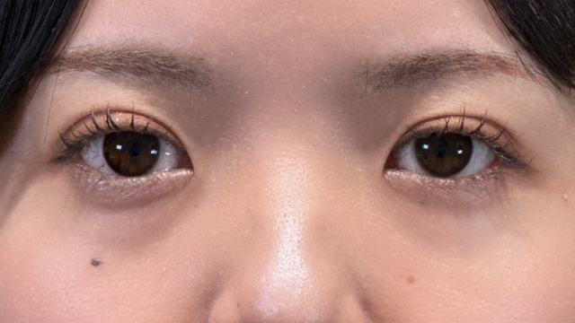 Postoperative Condition Part 1