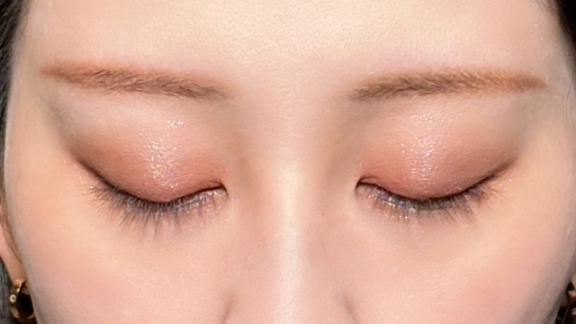 Postoperative Condition Part 1