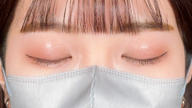 Postoperative Condition Part 1