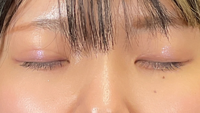 Postoperative Condition Part 1