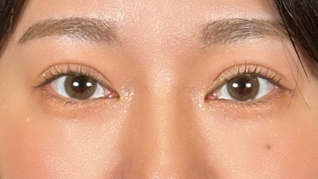 Postoperative Condition Part 1